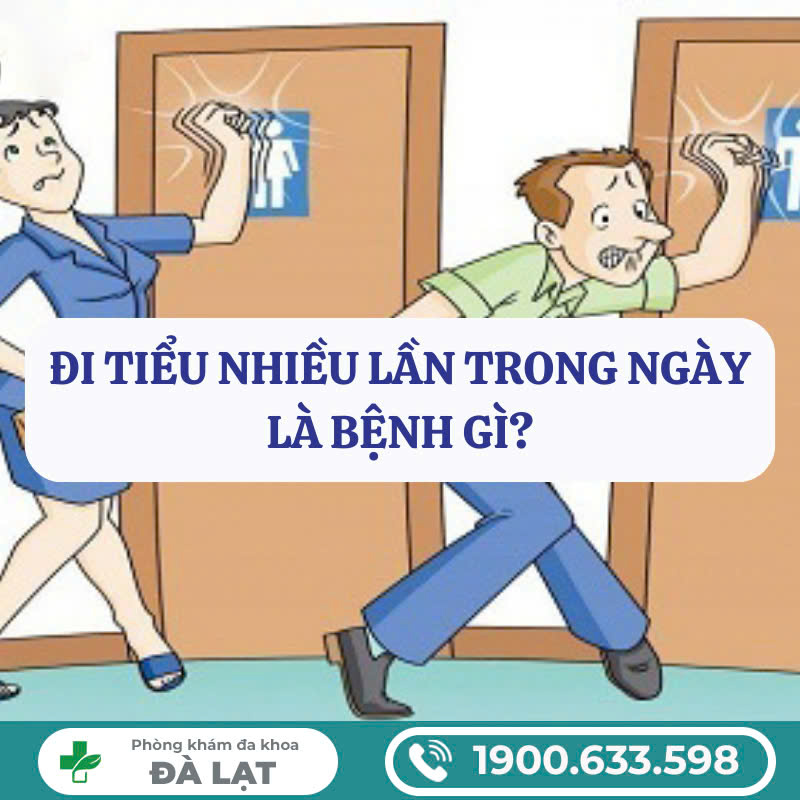 Hình ảnh minh họa